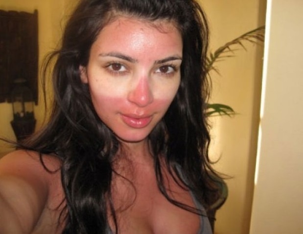Takto dopadla Kim Kardashian kvôli slneniu