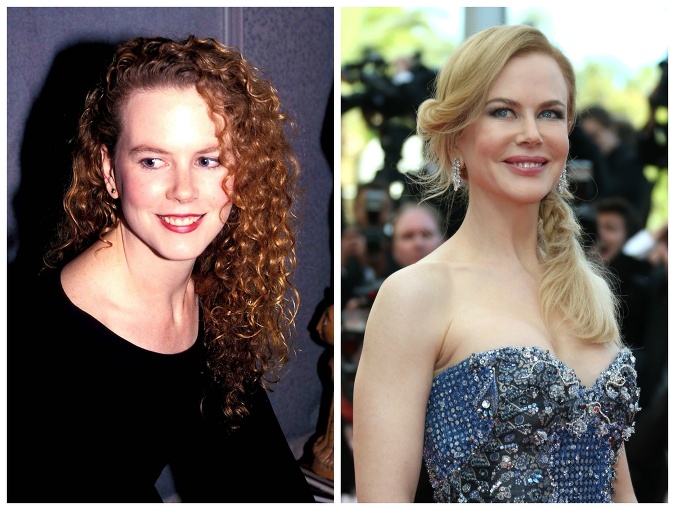 Nicole Kidman má za sebou množstvo zákrokov.