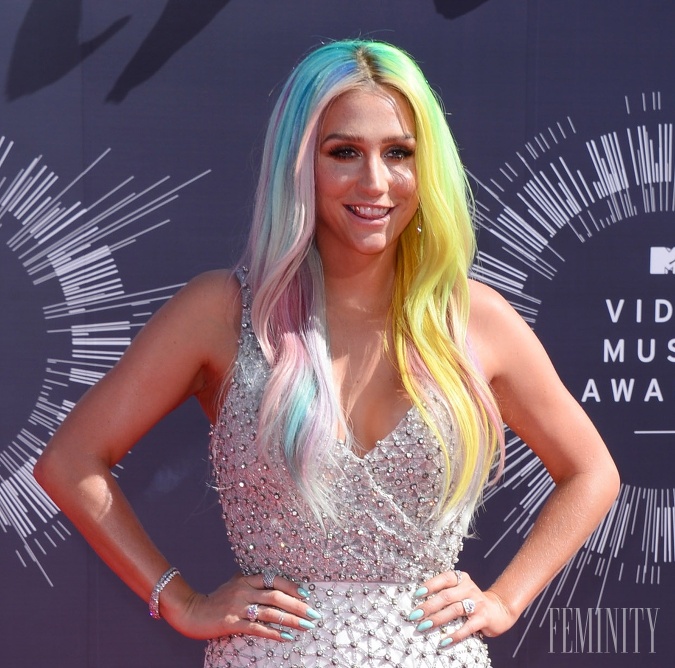 Kesha zažila niečo, čím sa môže pochváliť iba minimum ľudí