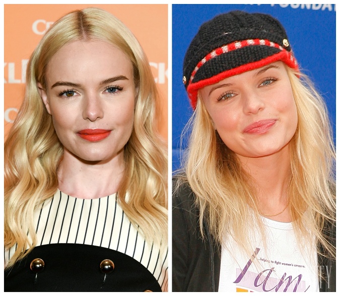 Kate Bosworth podstúpila zmenu nosa tiež v mladom veku