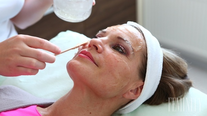 Príprava pokožky na laserové ošetrenie tváre