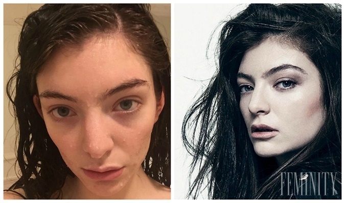 Speváčka Lorde si je vedomá svojich nedostatkov, rovnako ako aj toho, že je photoshopom väčšinou vyretušovaná
