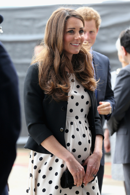 Nos Kate Middleton je najkopírovanejšou plastikou!
