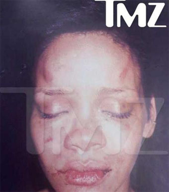 Rihanna, bitka