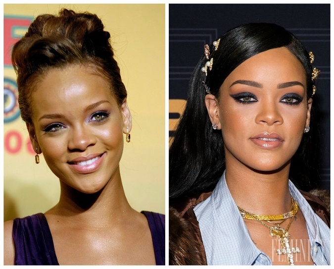 Speváčka Rihanna pred, a po úprave nosa
