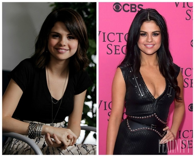 Herečka, a speváčka Selena Gomez pred, a po úprave nosa, a poprsia