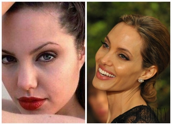 Angelina Jolie pred a po plastickej operácii nosa