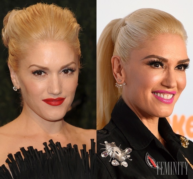 Speváčka, Gwen Stefani, sa rozhodla tiež nenechať starnutiu len prirodzený priebeh, ale jej súčasná tvár hovorí niečo iné