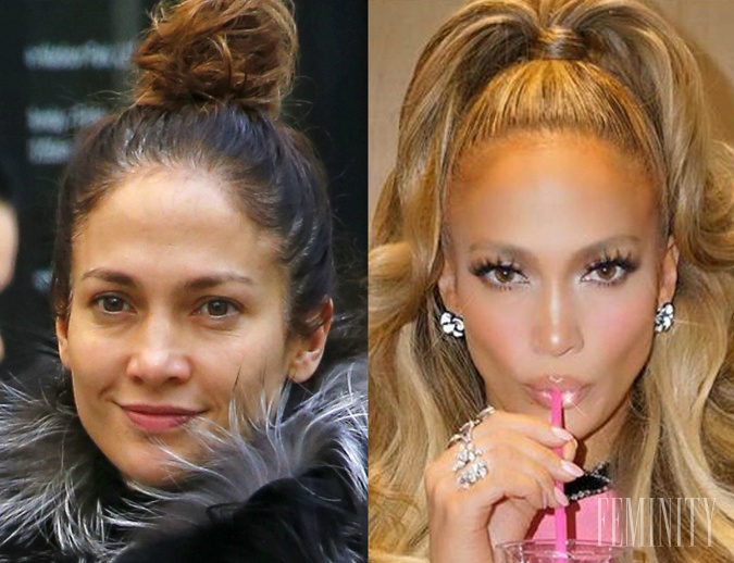 Prirodzená vs. upravená, kde je podľa vás Jennifer Lopez príťažlivejšia?